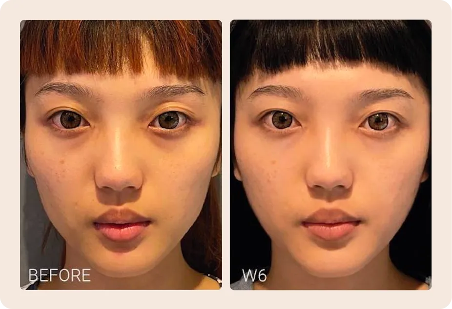 Actual treatment case by SALIENT. Results may vary and require professional physician evaluation.
