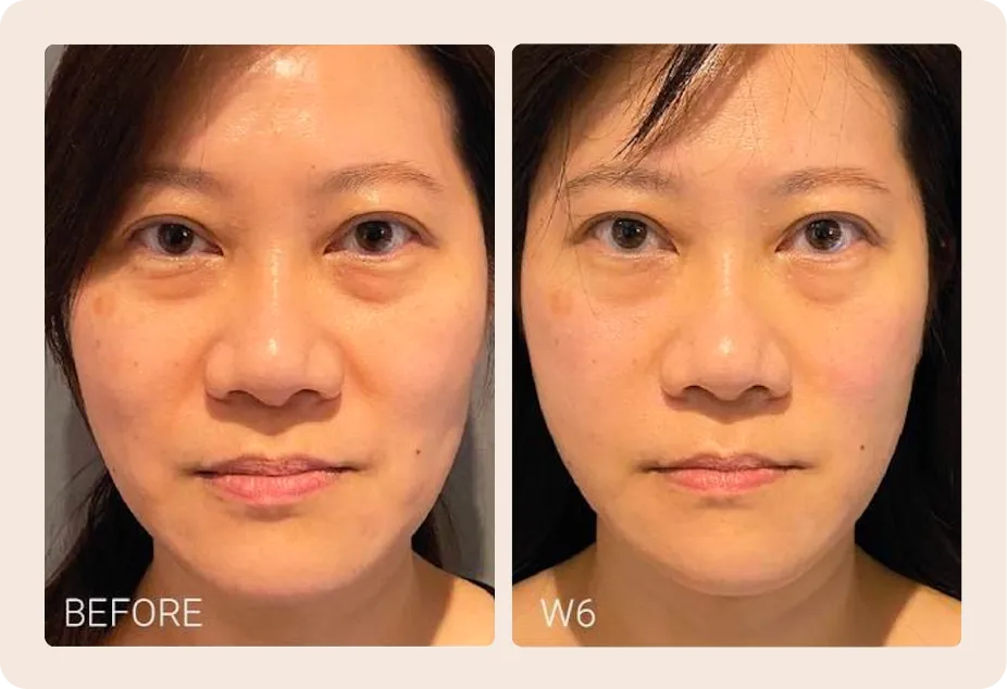 Actual treatment case by SALIENT. Results may vary and require professional physician evaluation.