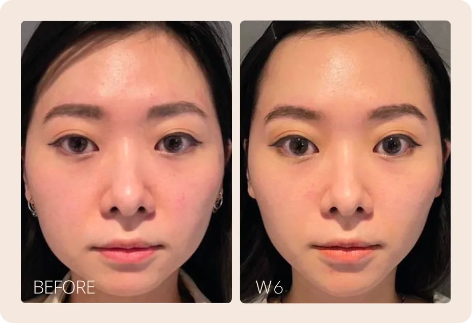 Actual treatment case by SALIENT. Results may vary and require professional physician evaluation.
