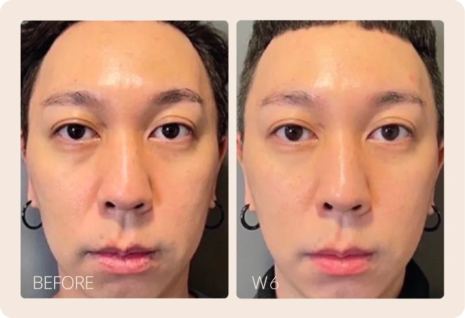Actual treatment case by SALIENT. Results may vary and require professional physician evaluation.
